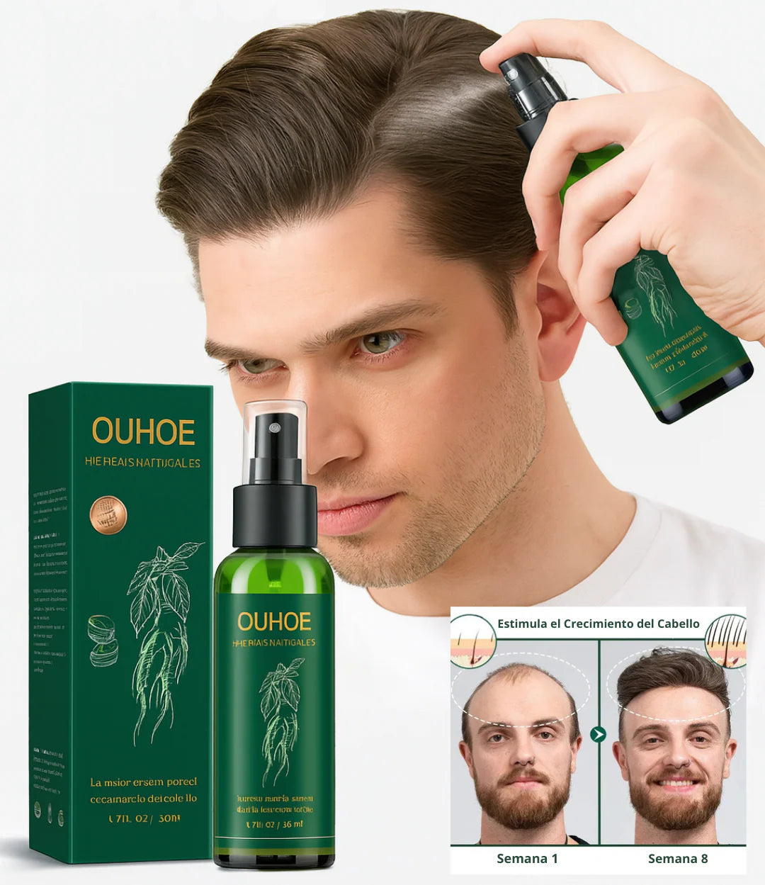 OUHOE PREMIUM - TÓNICO PARA CAIDA DE CABELLO